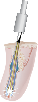 picoflash microflash